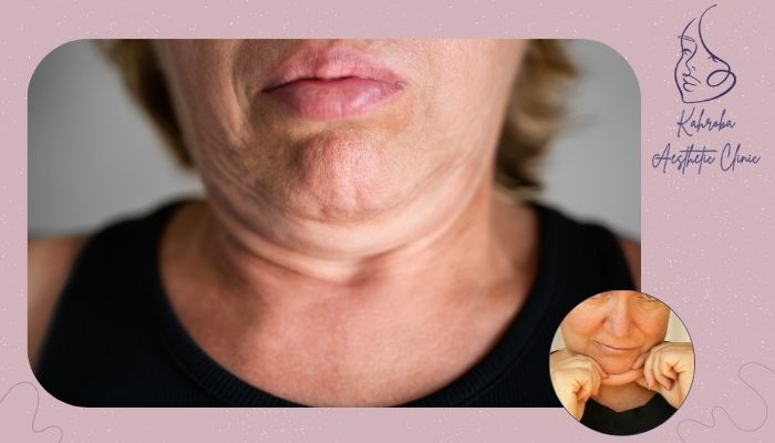 چگونه از بازگشت غبغب پس از ساکشن جلوگیری کنیم؟