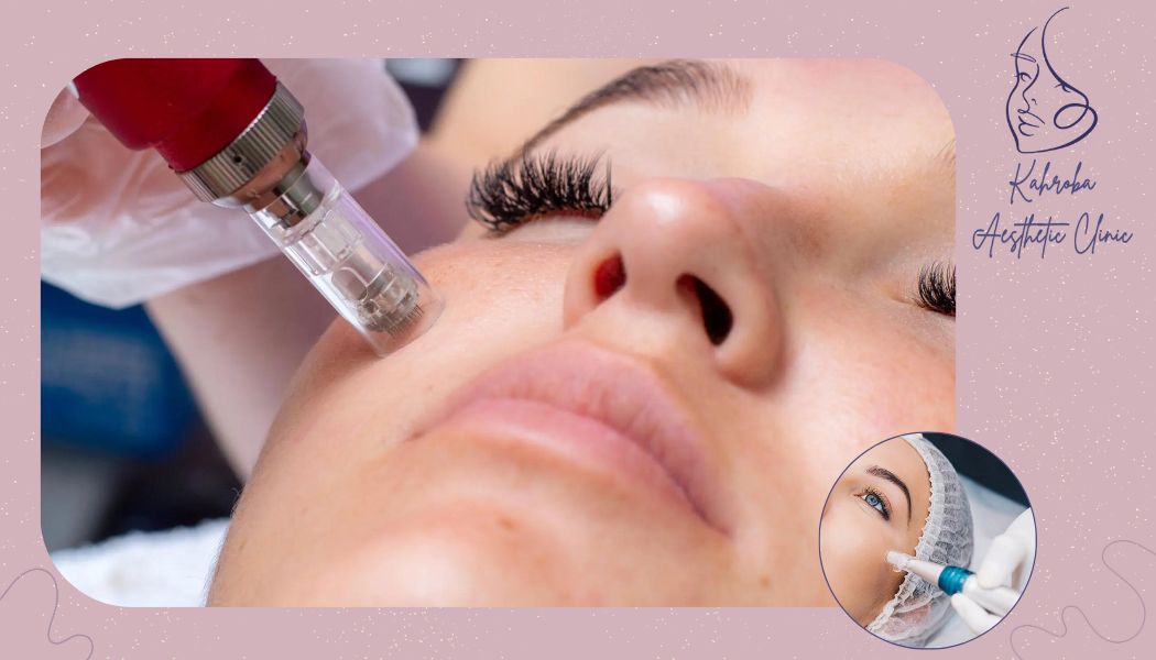 مراقبت های بعد از microneedling