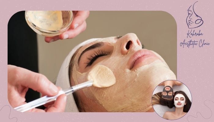 آیا پس از facial مراقبت خاصی دارد؟