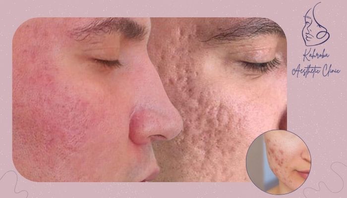 عوارض جانبی و خطرات احتمالی عوارض جانبی و خطرات احتمالی