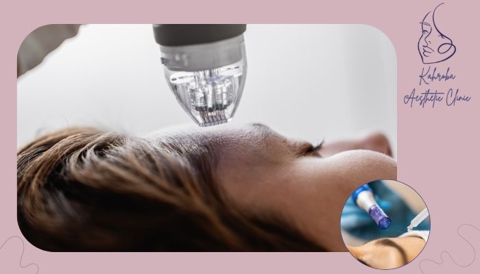 مزایای این دو روش جوان‌سازی