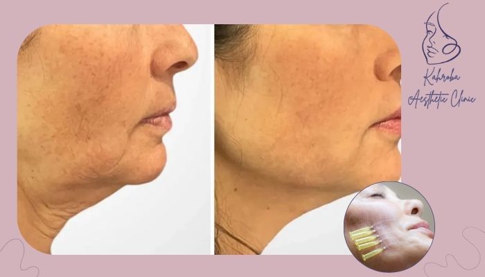 راهکارهای افزایش ماندگاری