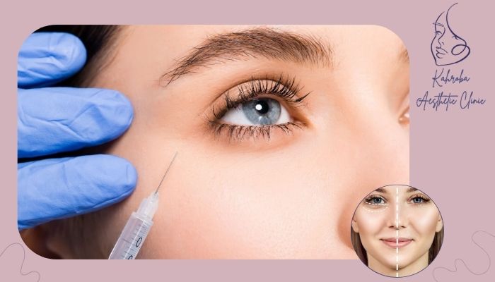 فیلر زیر چشم برای چه کسانی ممنوع است؟ فیلر زیر چشم برای چه کسانی ممنوع است؟