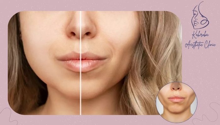 هدف از برداشتن چربی بوکال چیست؟