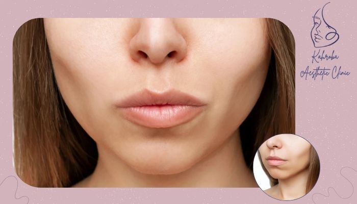 آیا بوکال فت باعث تحلیل رفتن گونه در سنین بالا می‌شود؟