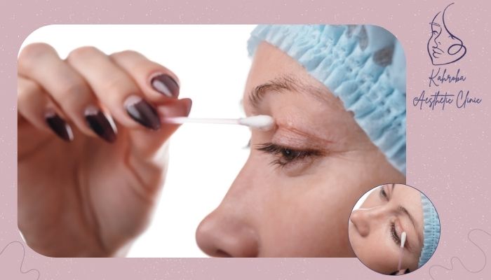چطور از ماندن جای بخیه جلوگیری کنیم؟