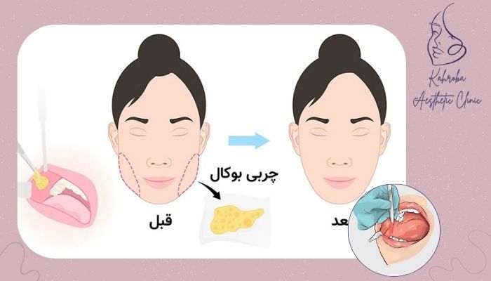 نکات مهم برای آمادگی و بهبودی بعد از جراحی