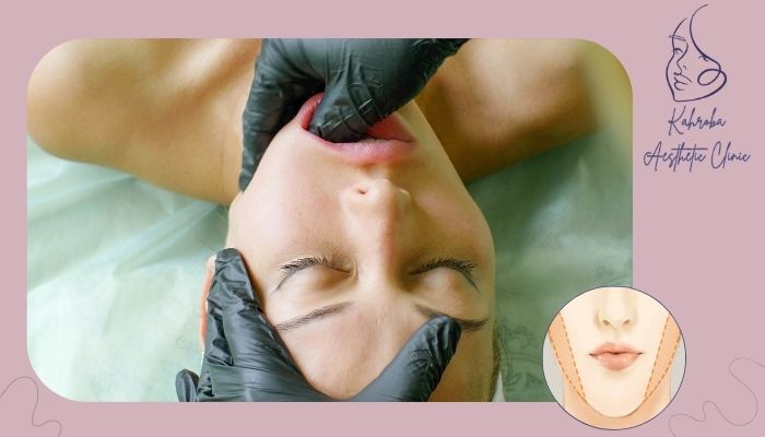 تورم صورت بعد از بوکال فت