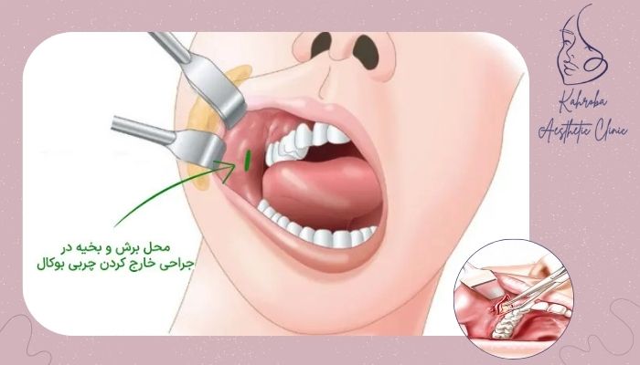 مراقبت‌های لازم پس از جراحی
