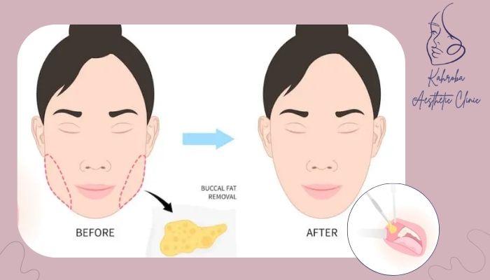 عوامل موثر بر افزایش ورم